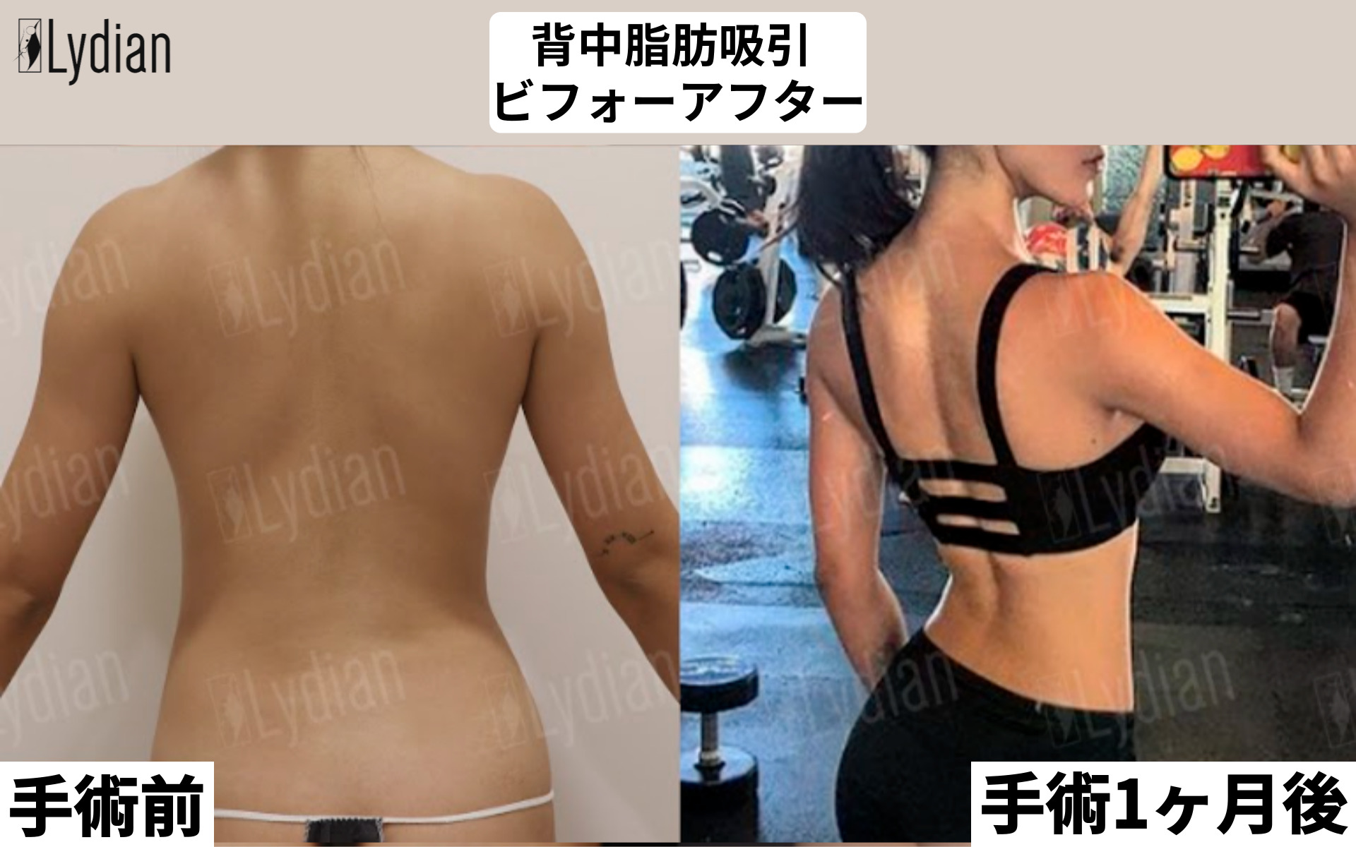 背中のビーナスラインの作り方｜骨格の真相と短期間で変わる美背中トレ