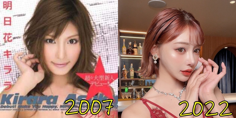 【2026年最新】明日花キララが明かした美容整形のリアル｜「なりたい顔」No.1であり続ける理由と美の変遷