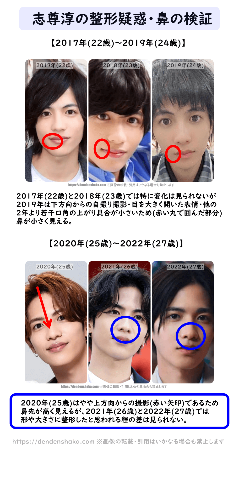 志尊淳の整形疑惑は本当？昔の画像と卒アル比較で判明した激変の真相