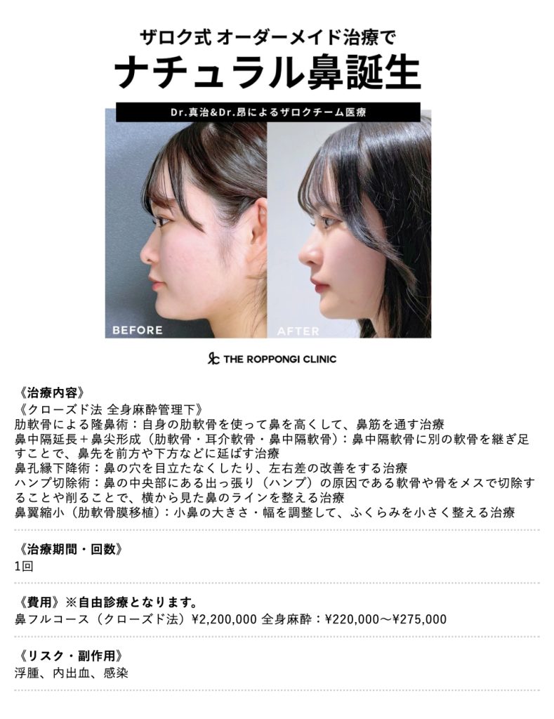 鷲鼻とは？段鼻・魔女鼻との違いや美男美女の理由と最新修正術を解剖