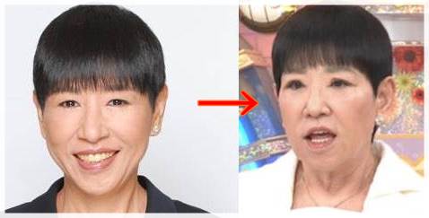 【話題】 和田 アキ子 眼瞼 下垂 公式インスタ・X最新情報 #713