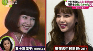 【衝撃】 中 村里 砂 整形 前 2026年最新メディア #709