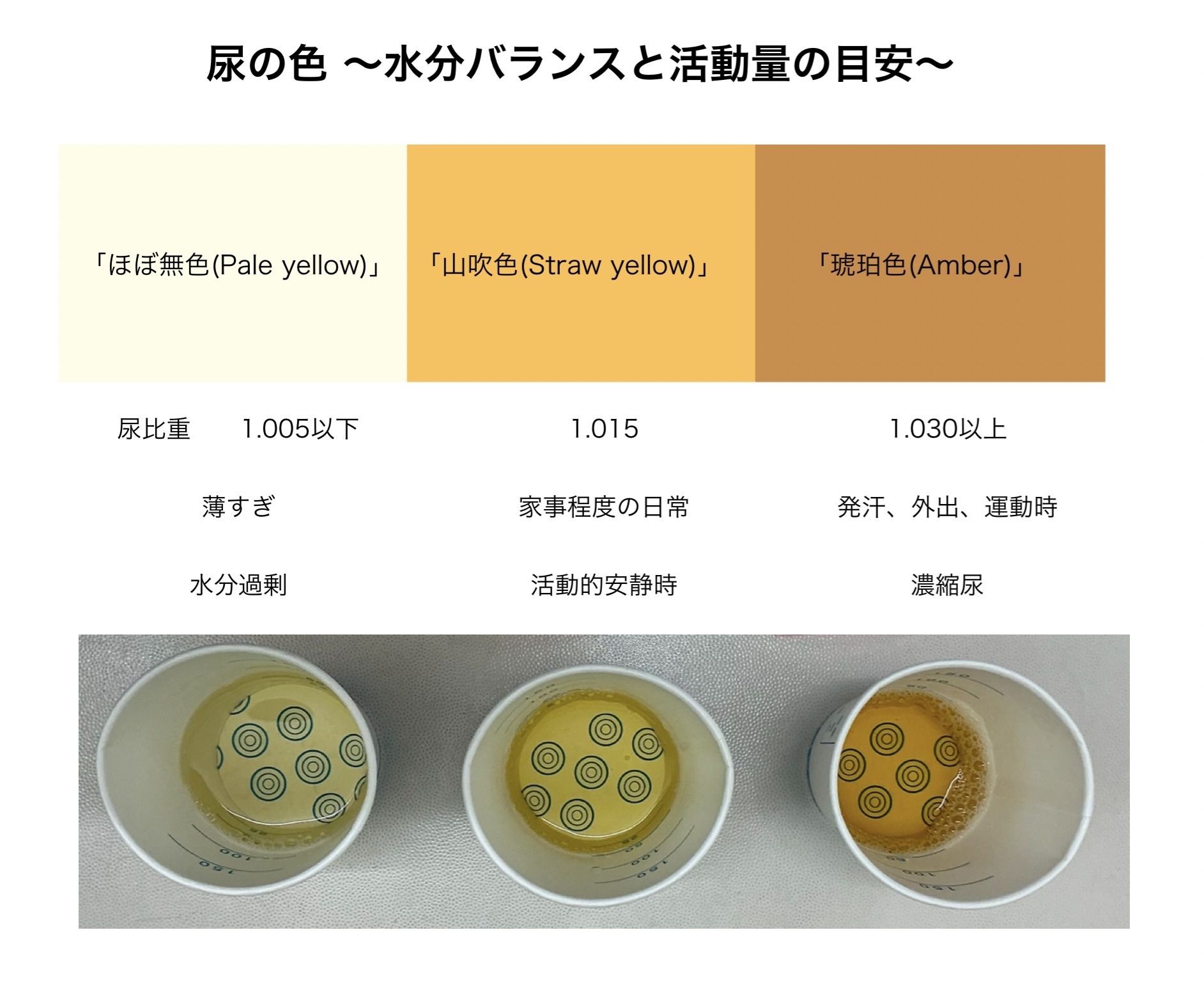 尿の色写真で危険サインを判別！赤や茶色に潜む重大リスクと受診目安
