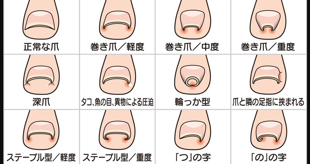 【動画まとめ】 爪 に 現れる 病気 の サイン 経歴＆学歴まとめ 2026 #652
