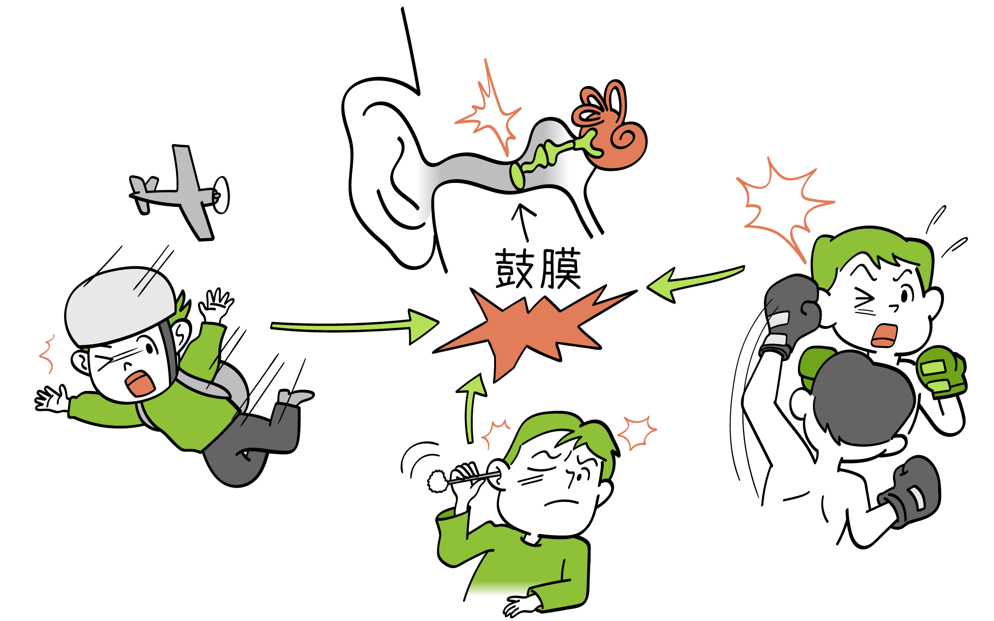 鼓膜が破れる痛みは激痛だけじゃない？無痛の真相と自然治癒・治療法