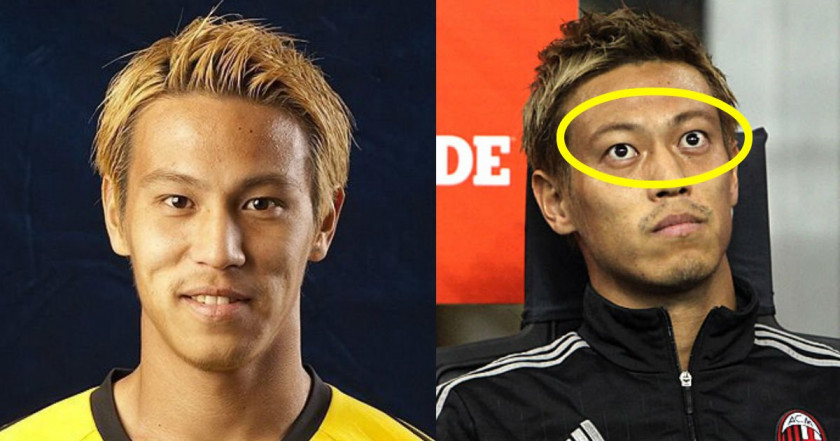 本田圭佑の病気説と目の違和感！バセドウ病噂の真相と現在の姿