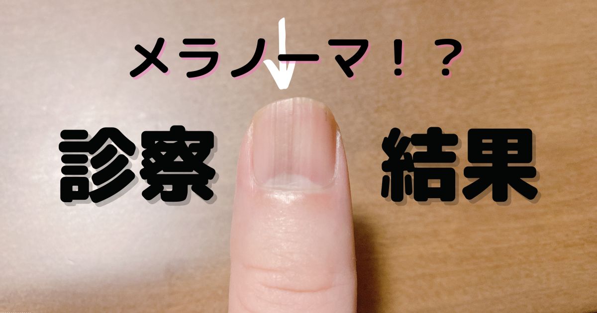 まるばつゲーム必勝法と絶対に負けない手順｜三目並べ完全攻略