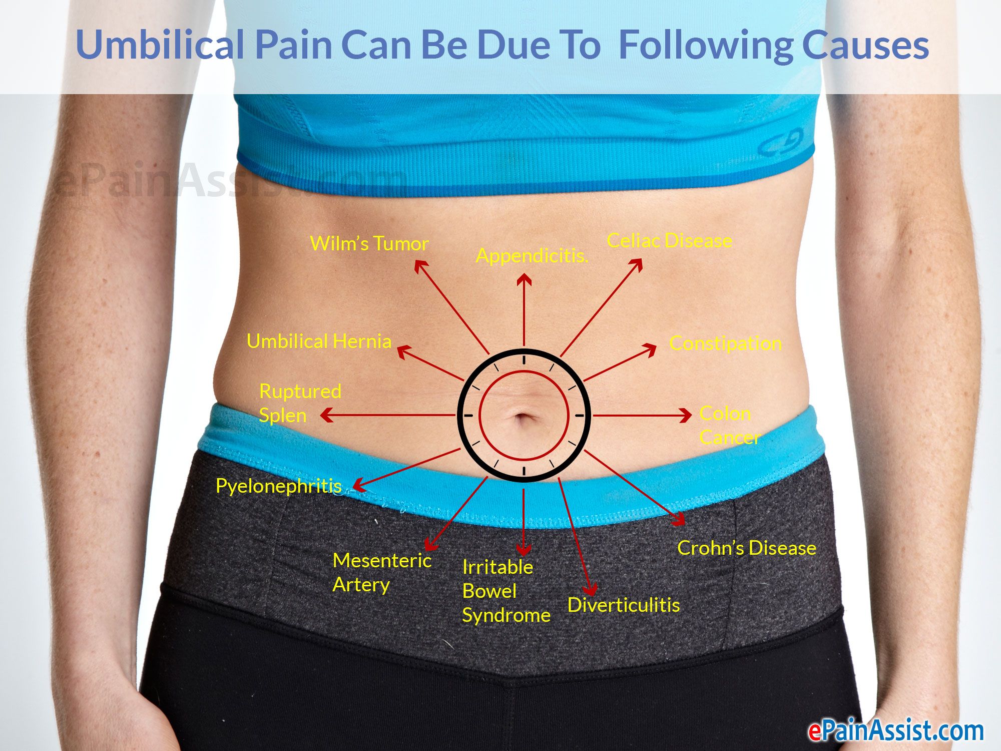 Pain in Abdomen on Right Side of Belly Button