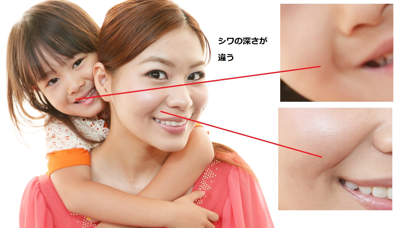 笑った時のほうれい線が消えない？残る原因と即効改善法を徹底解説