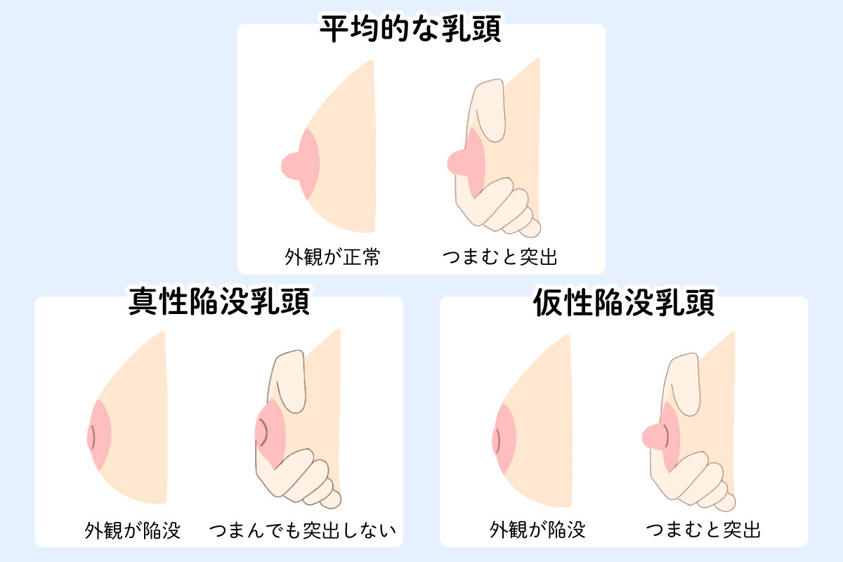 乳頭マッサージはいつから？助産師が明かす開始時期と安全な手順