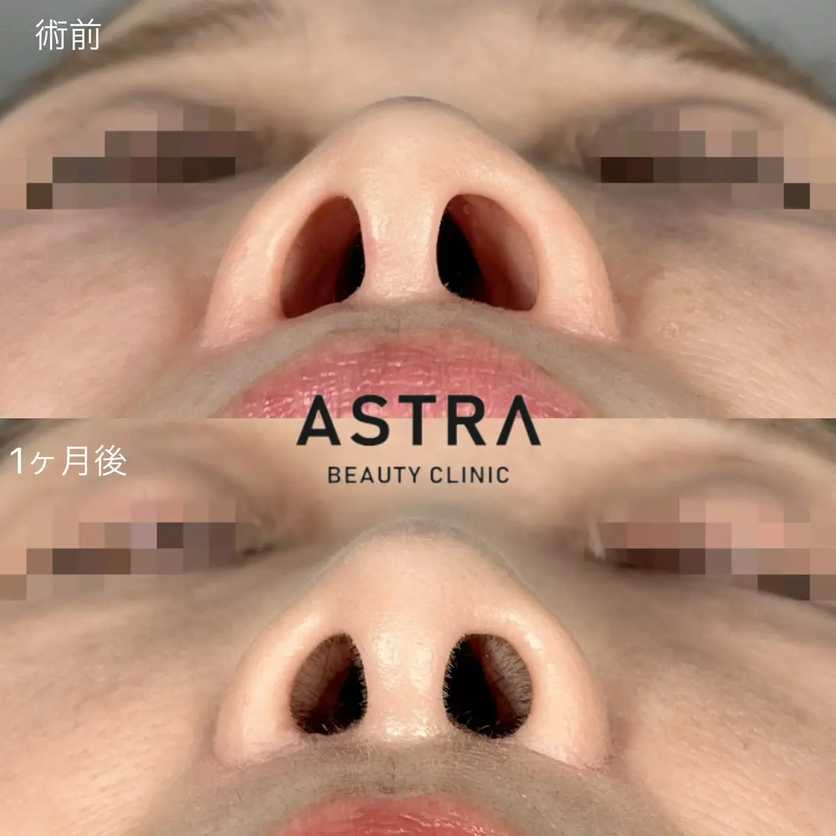 鼻の穴が大きい人の隠された魅力とは？人相学と最新美容の真相