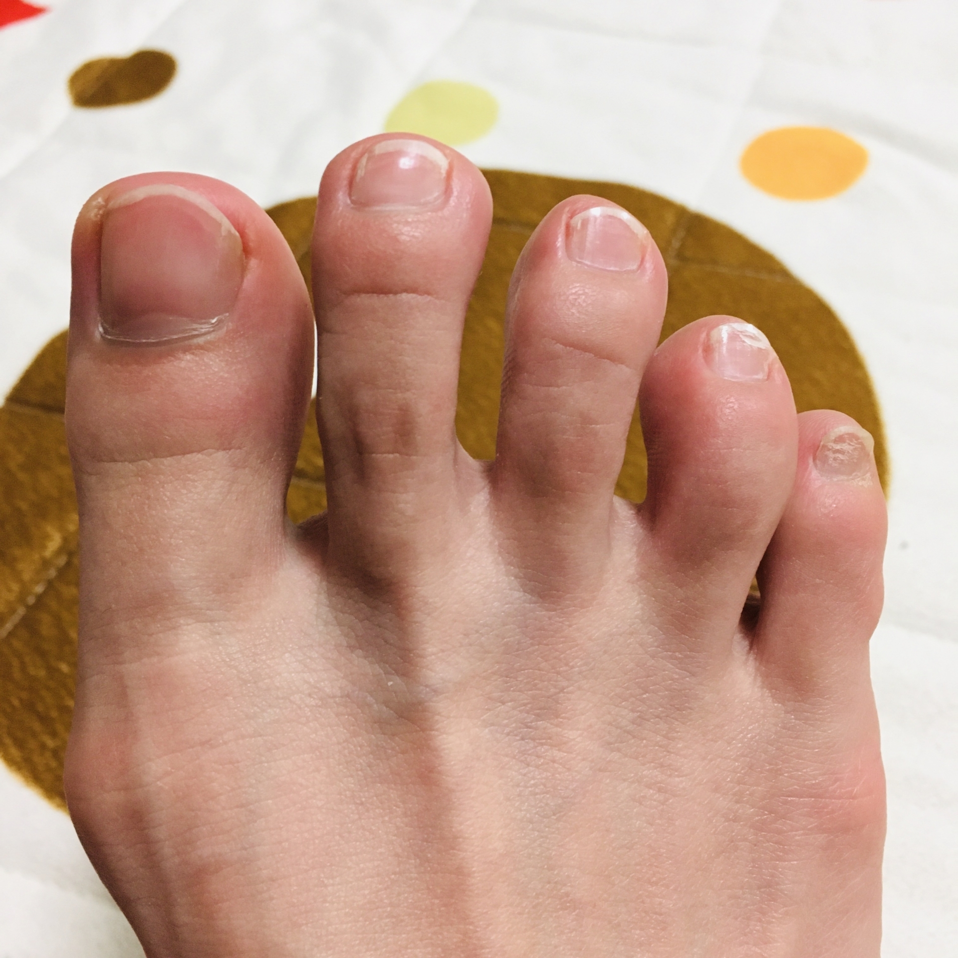 足の爪の色が悪い原因は？白濁・黒変色の危険度と何科を受診すべきか解説