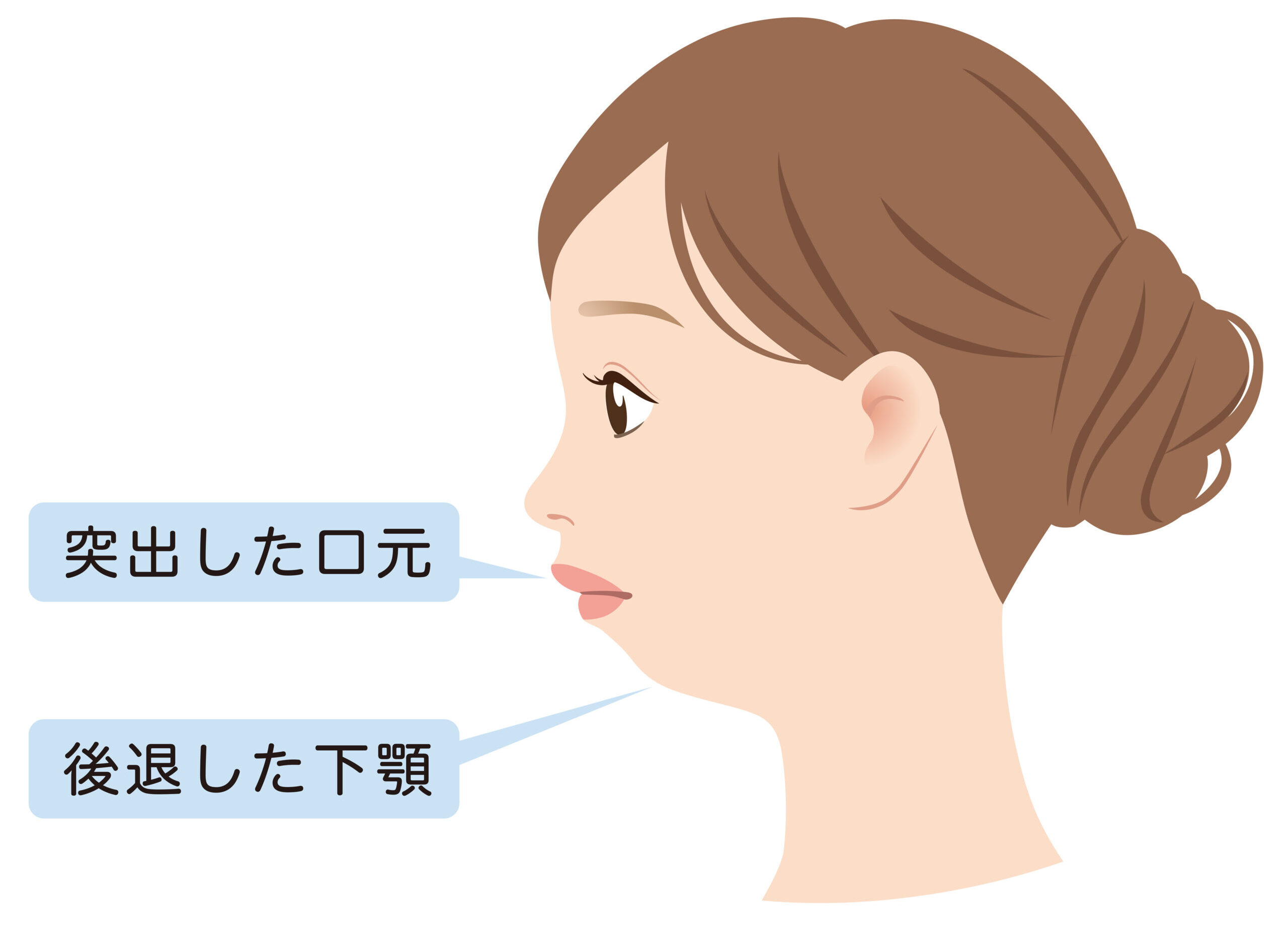 「顎がない」悩みを解消！横顔のEラインを整える最新アプローチ