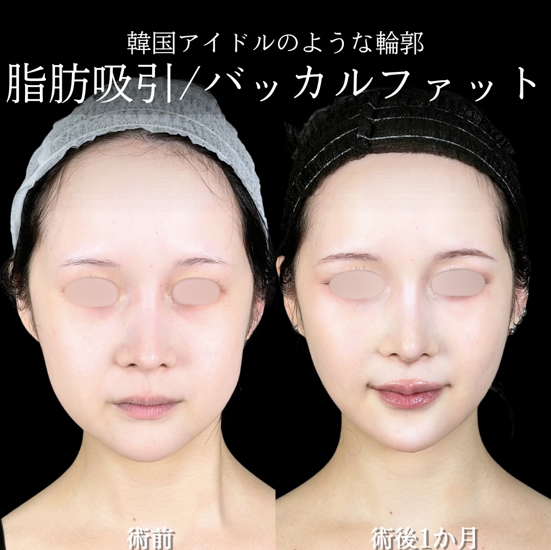 顔がでかい悩みを解消！原因の真相と劇的に垢抜ける小顔の法則2026