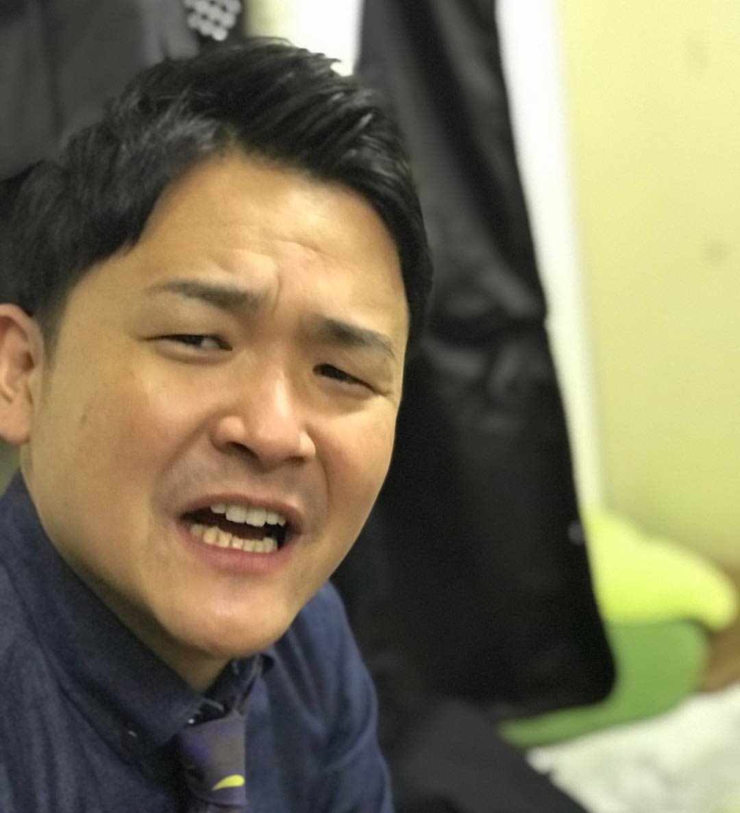 千鳥ノブの顔が変わった理由とは？激変の真相と健康状態を徹底検証