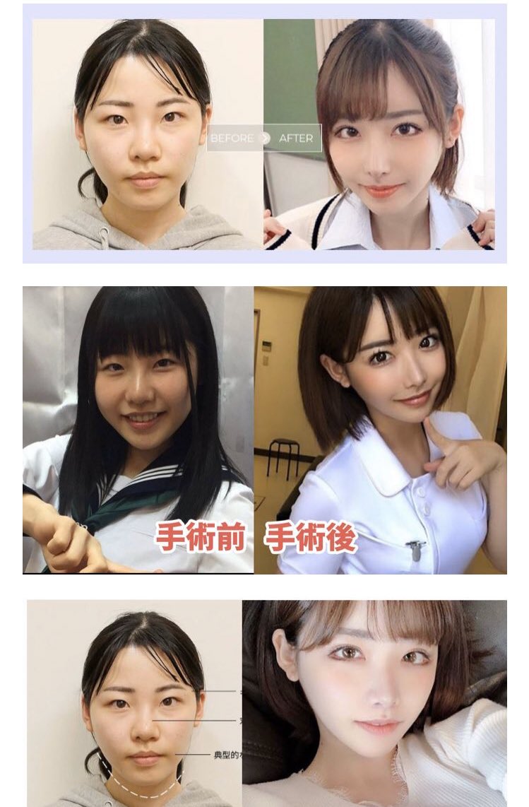 深田えいみの昔と現在を比較｜地下アイドルから整形公表に至る全軌跡