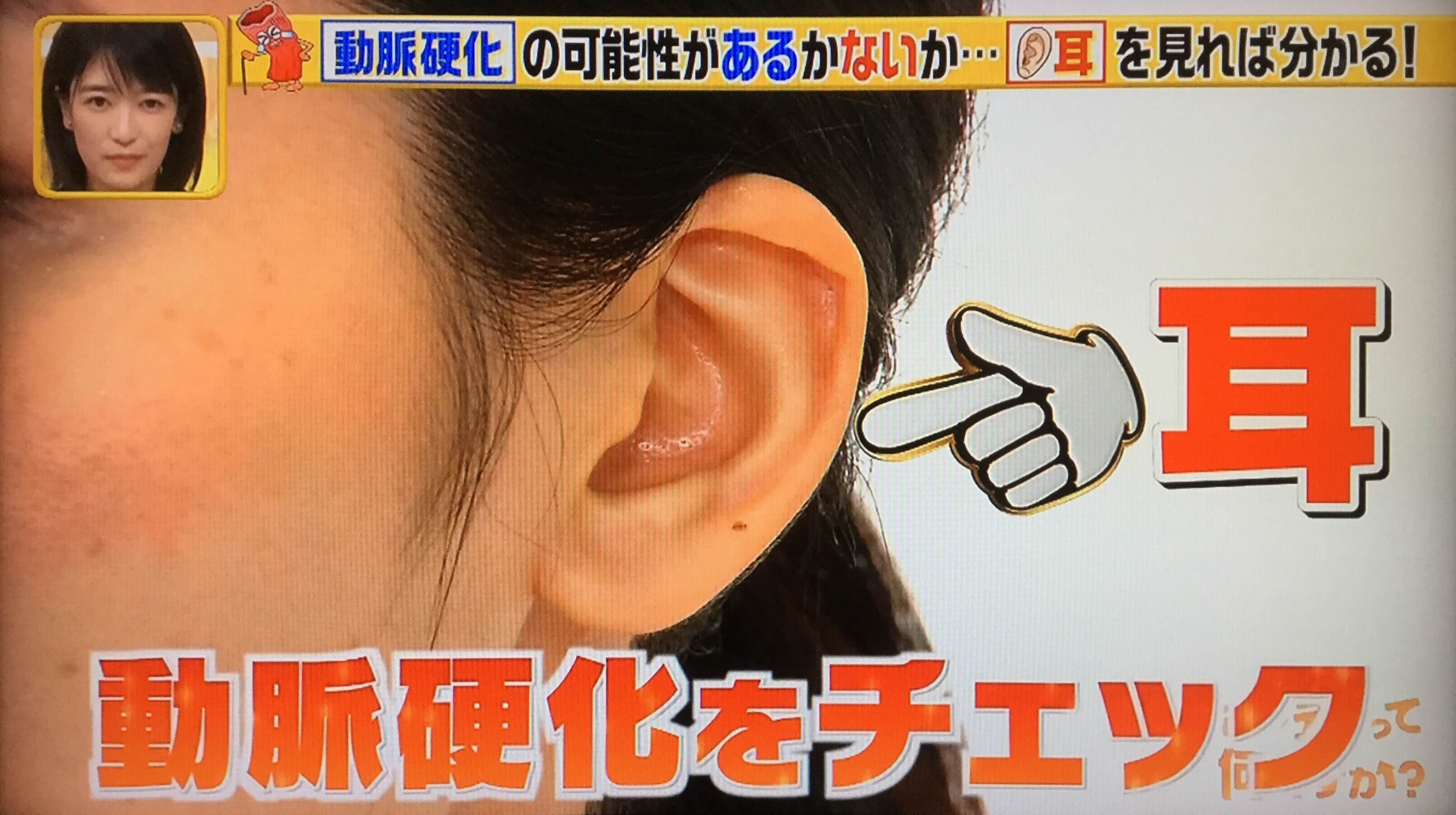 耳たぶのしわは動脈硬化の予兆？危険度の見分け方と簡単セルフチェック