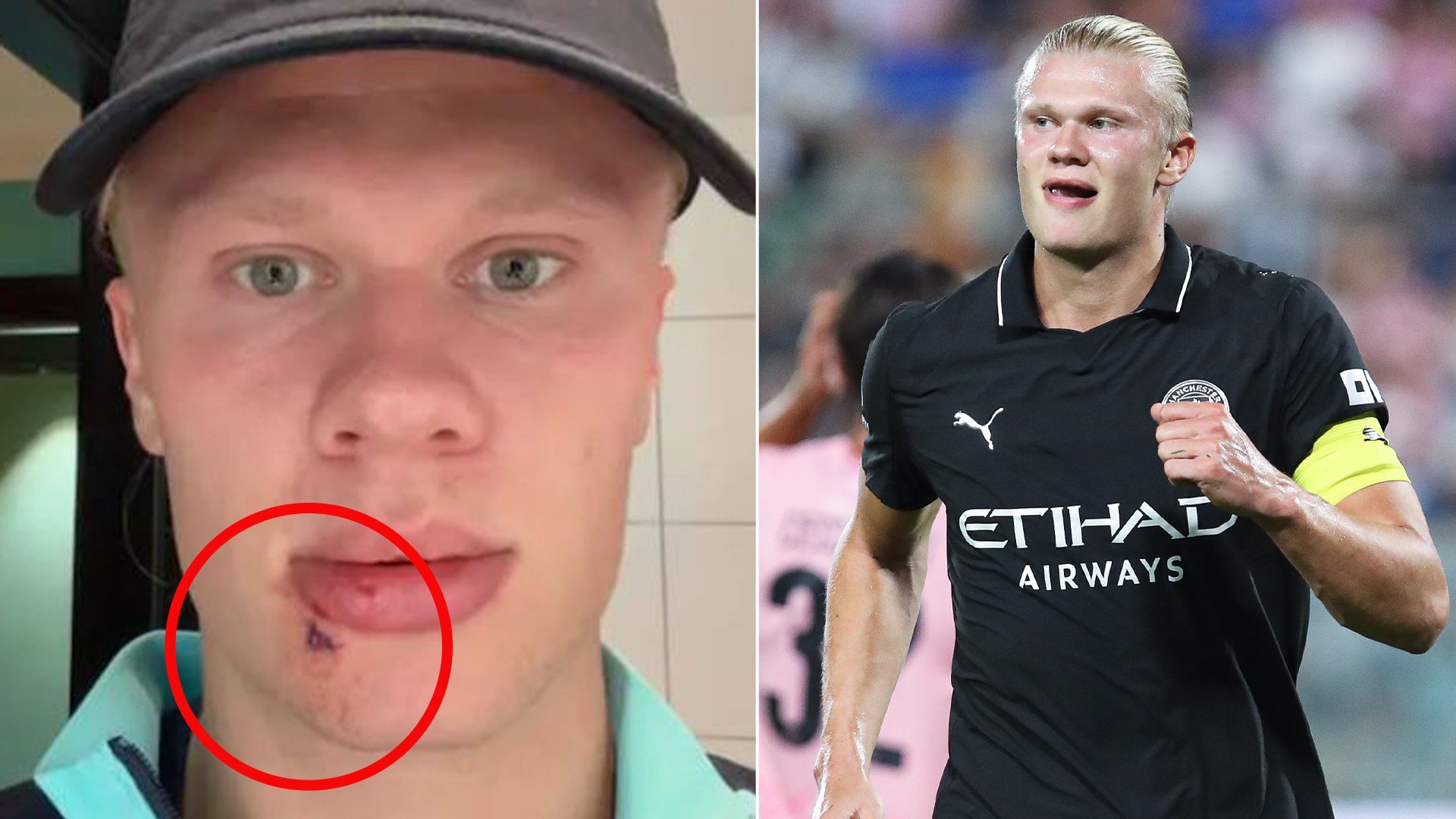 Did Erling Haaland Get a Buzz Cut? His New Style Sparks Debate
