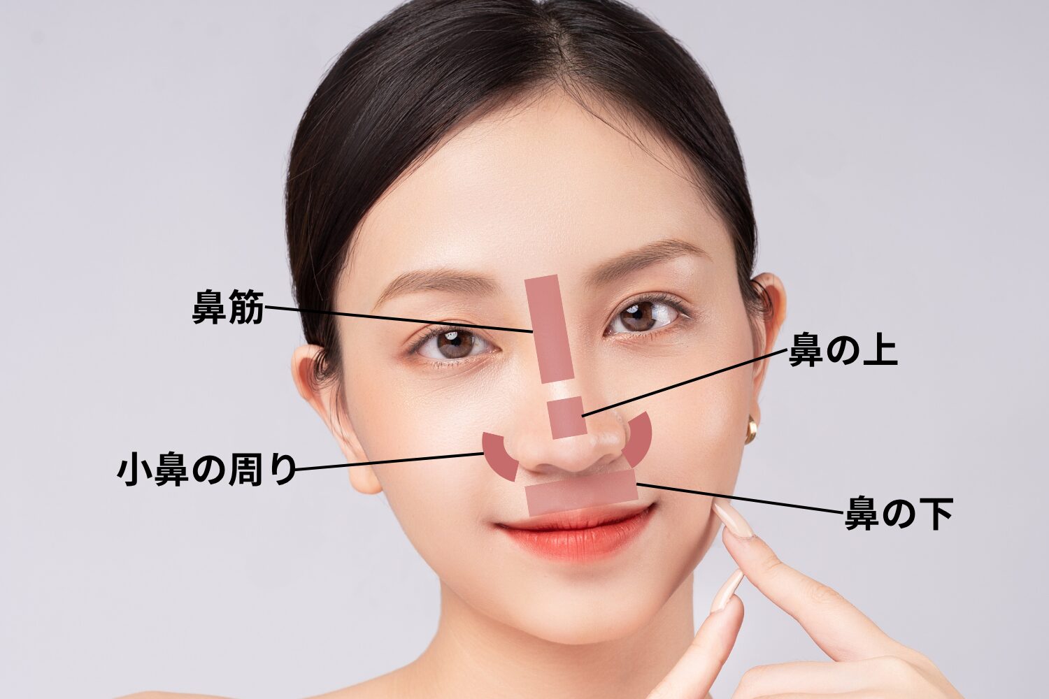 鼻の周りのニキビが繰り返す理由！皮膚科医が明かす最新治療とケア