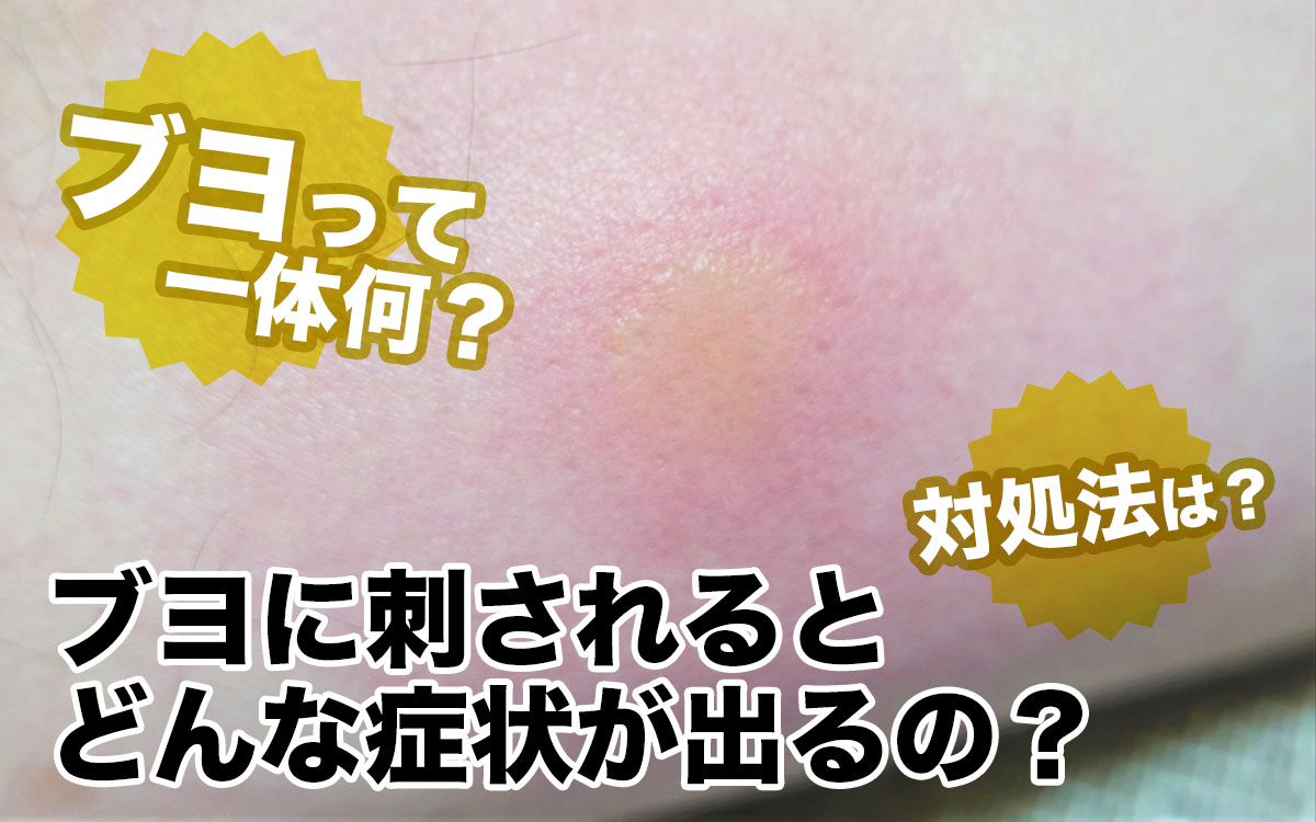 ブヨに刺された跡の画像と経過｜蚊との違いや腫れ・しこりの対処法