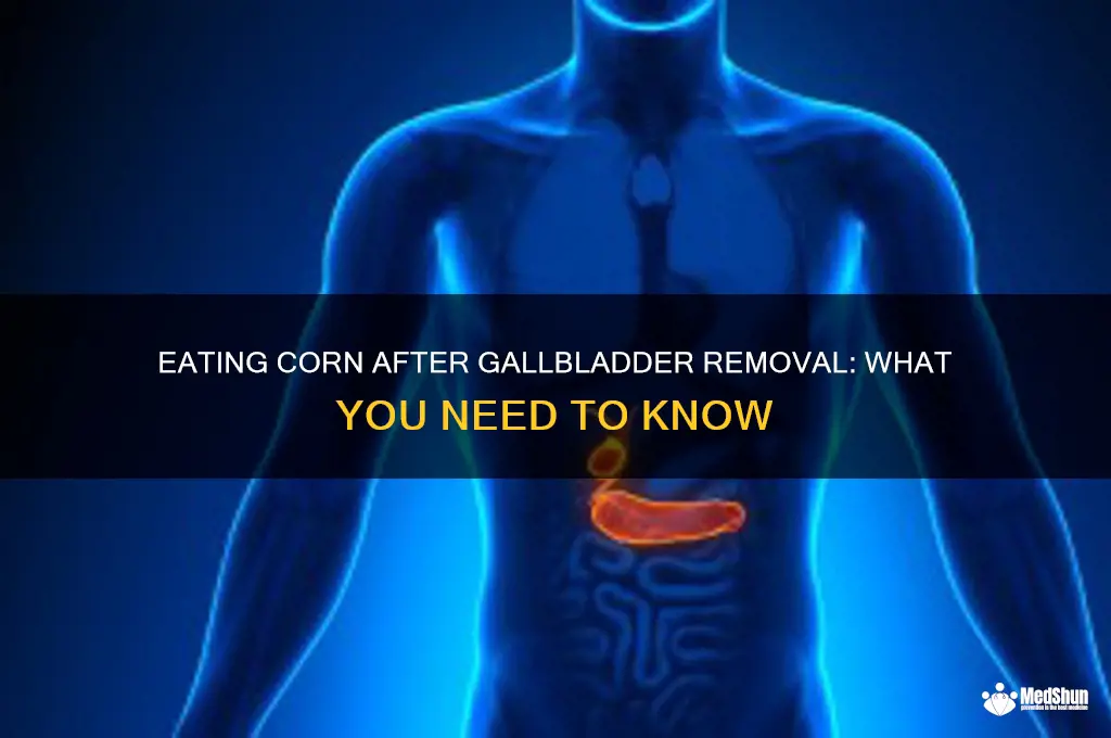 Can I Eat Corn After Gallbladder Removal