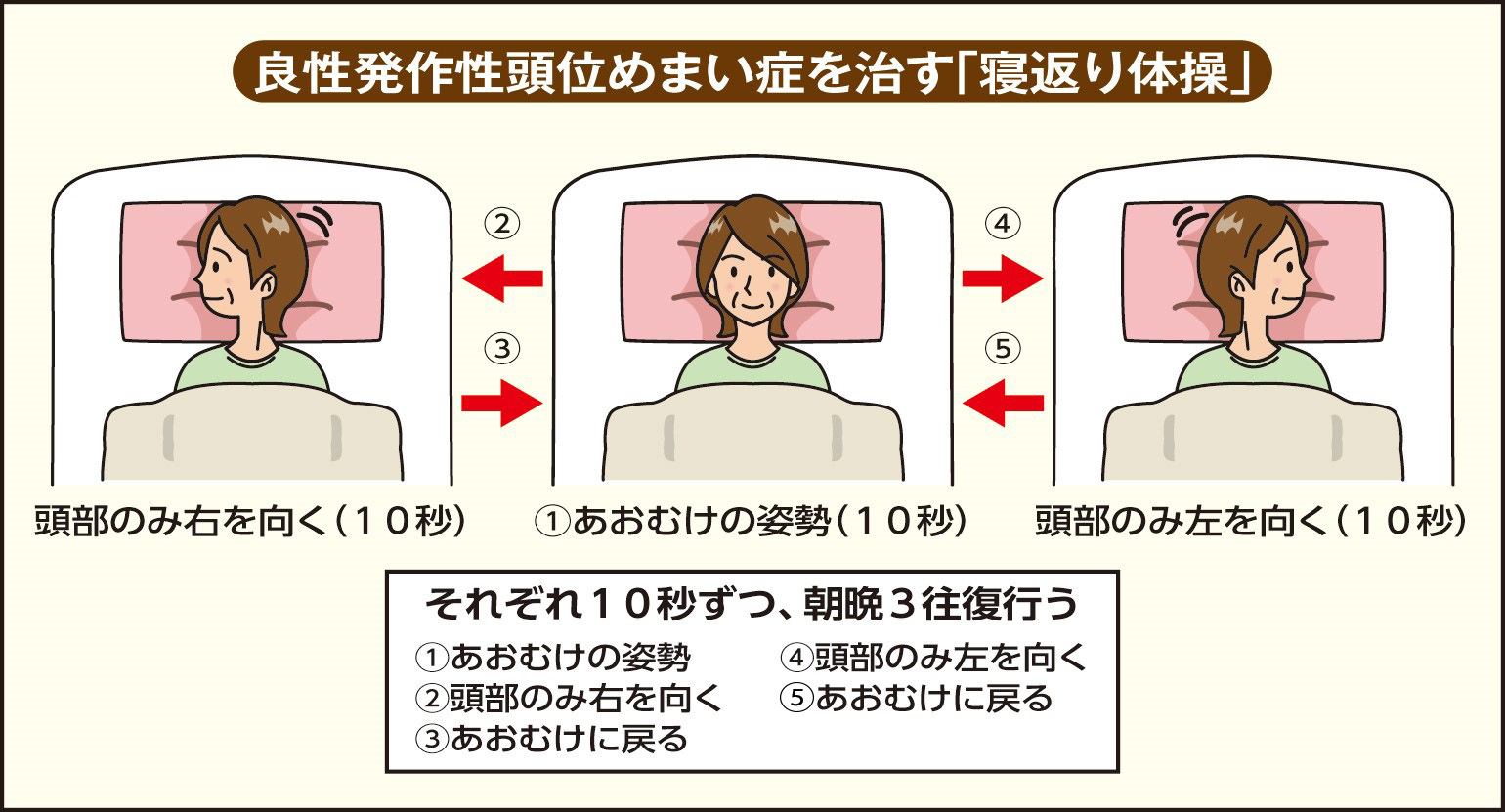 良性発作性頭位めまい症の体操で悪化する原因とは？正しい耳石の戻し方