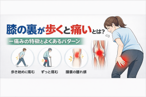 【速報】 膝の裏 歩くと痛い 知恵袋 Tiktok話題の動画 #721