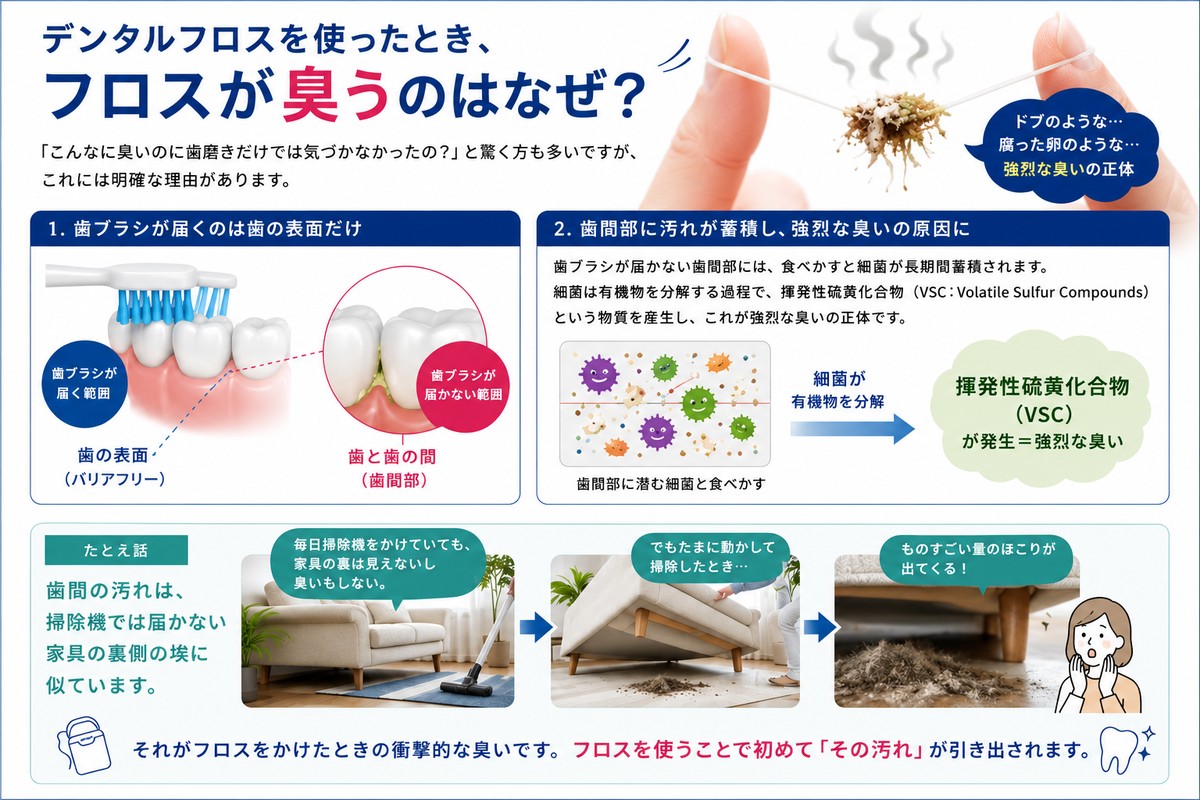 デンタルフロスの臭い玉の正体とは？悪臭の根本原因と劇的改善策