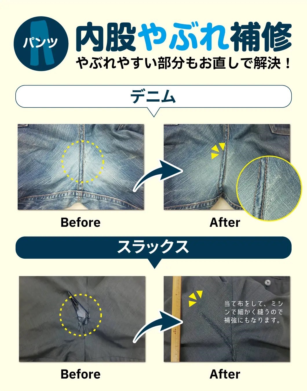 股が裂ける激痛の正体は？ストレッチや出産で起きる原因と治し方