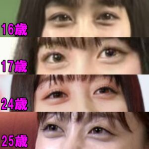 橋本環奈の「顔貌変化」を徹底検証：ネットを騒がせる整形疑惑の真相と、2026年現在のリアル