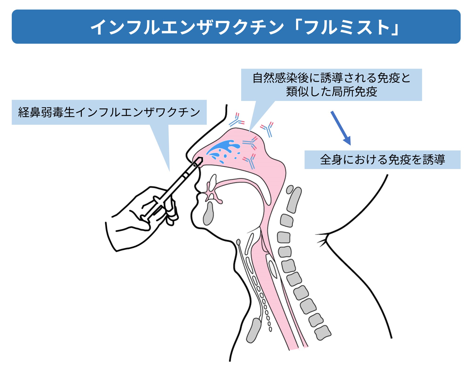 痛くない点鼻インフルワクチンの真相！注射との違い・効果を徹底比較