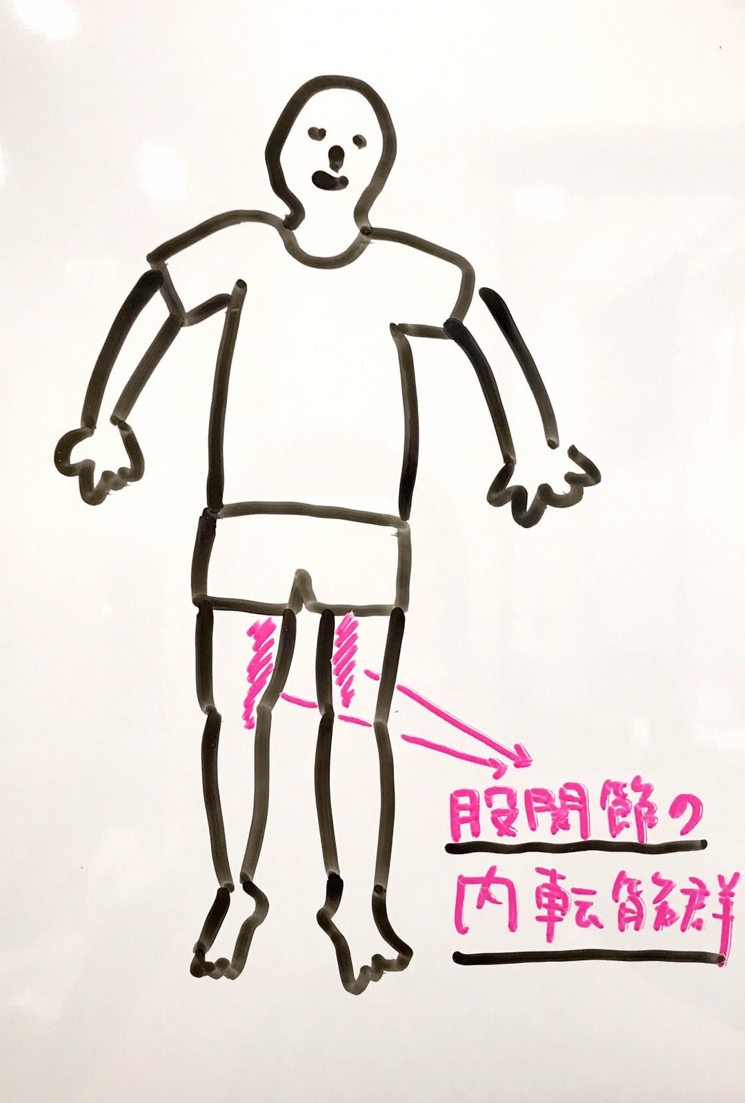 太ももの内側がつる激痛の正体｜即効の応急処置と隠れた病気のサイン