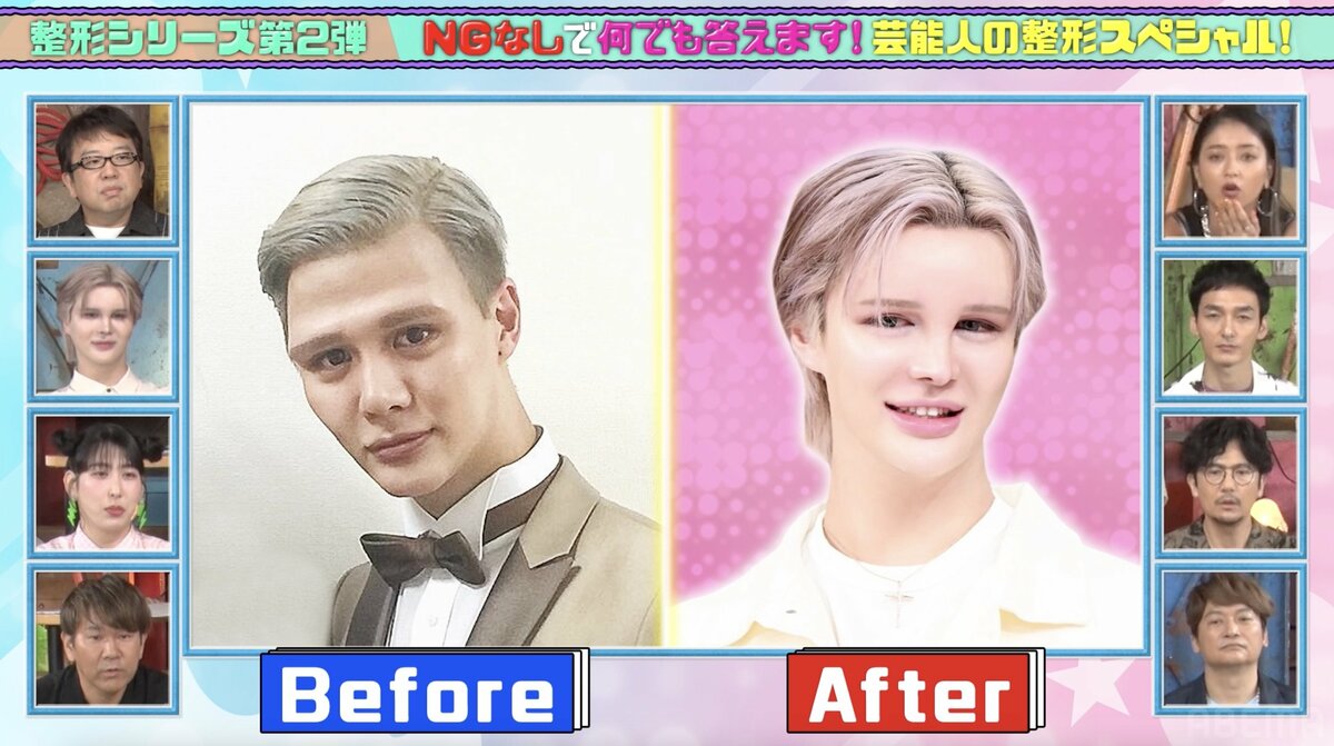 Matt顔の変化を時系列で徹底比較！整形疑惑の真相と美容哲学