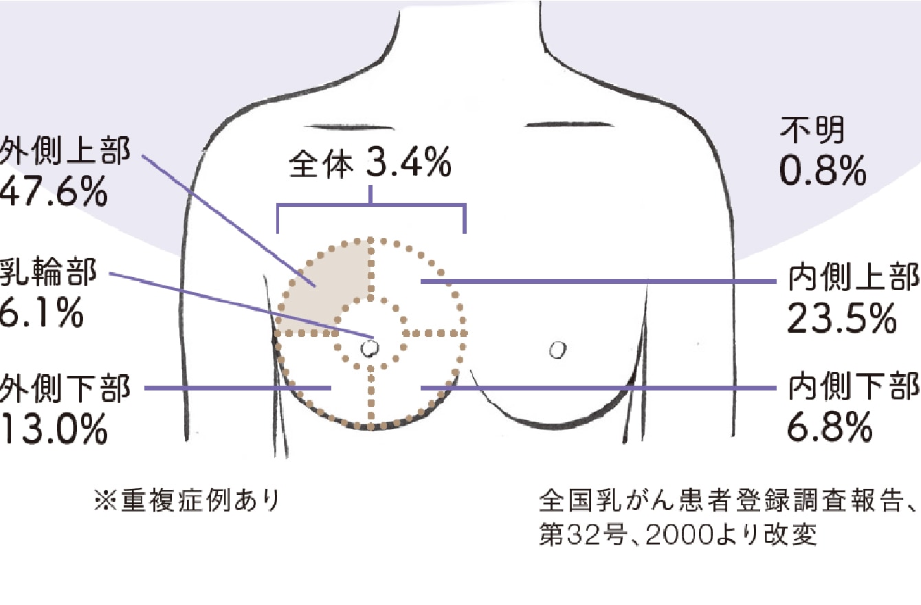 胸がチクチク痛む原因とは？左右の差と今すぐ受診すべき危険サイン