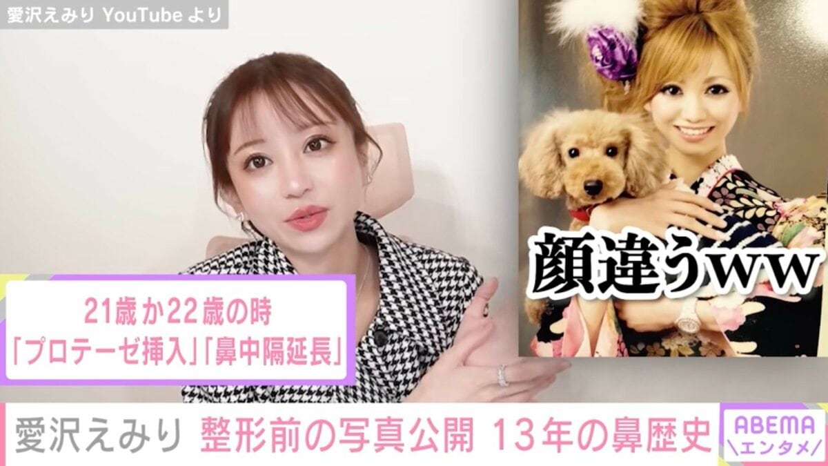 愛沢えみりの整形前と現在の変化｜公表した施術と引き算美容の全貌
