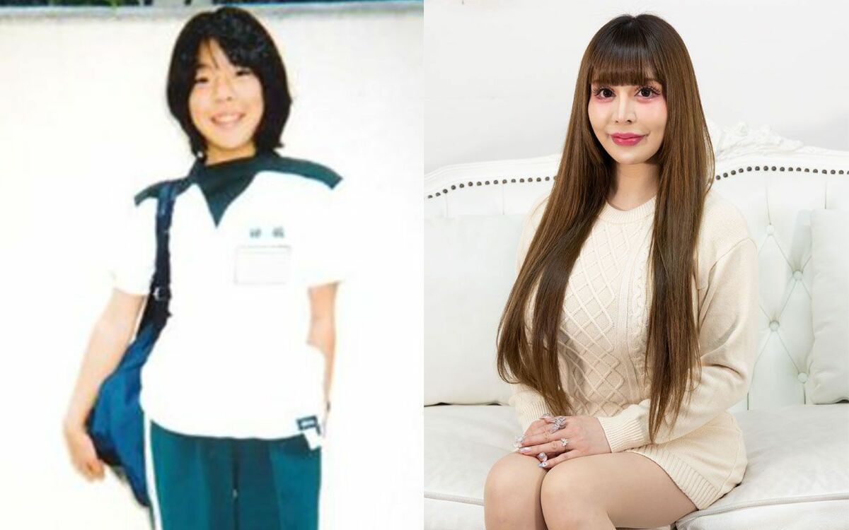 総額3億の整形美女ヴァニラ｜整形前の素顔・卒アルと現在の姿