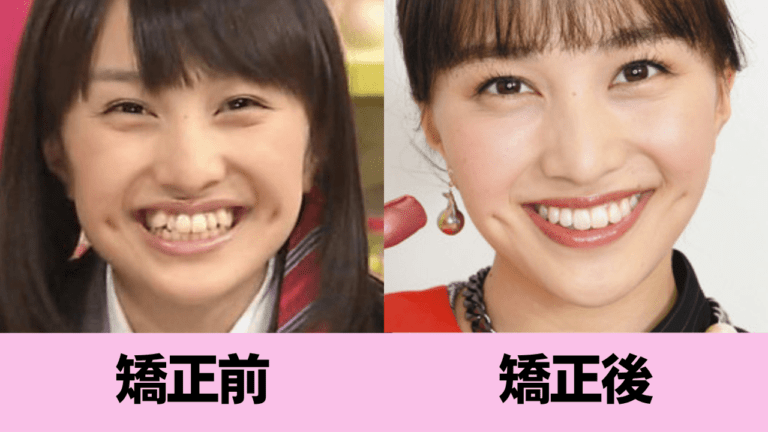 百田夏菜子は本当に老けたのか？激変説の真相と最新ビジュアル検証