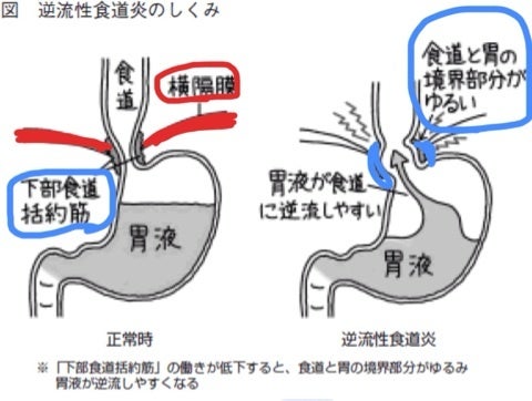 食後のゴロゴロは悪じゃない？胃酸逆流を防ぐ「正しい体の向き」と最新の消化科学