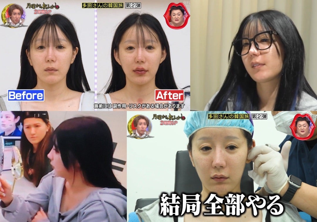 多田さんの整形前の顔とは？昔の写真や施術箇所・総額まで徹底検証