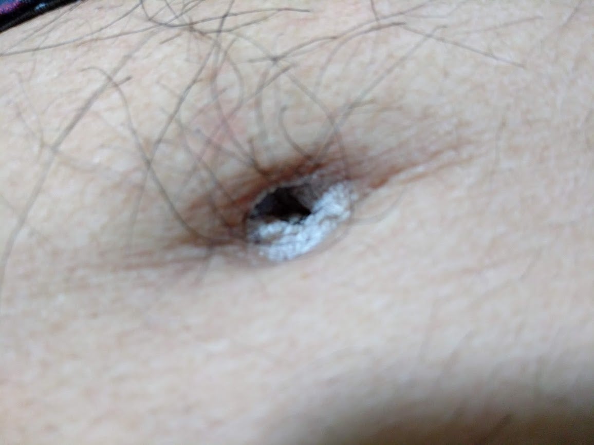 ヘソが白い原因は垢か病気か？奥の塊の正体と正しいケア法を解説