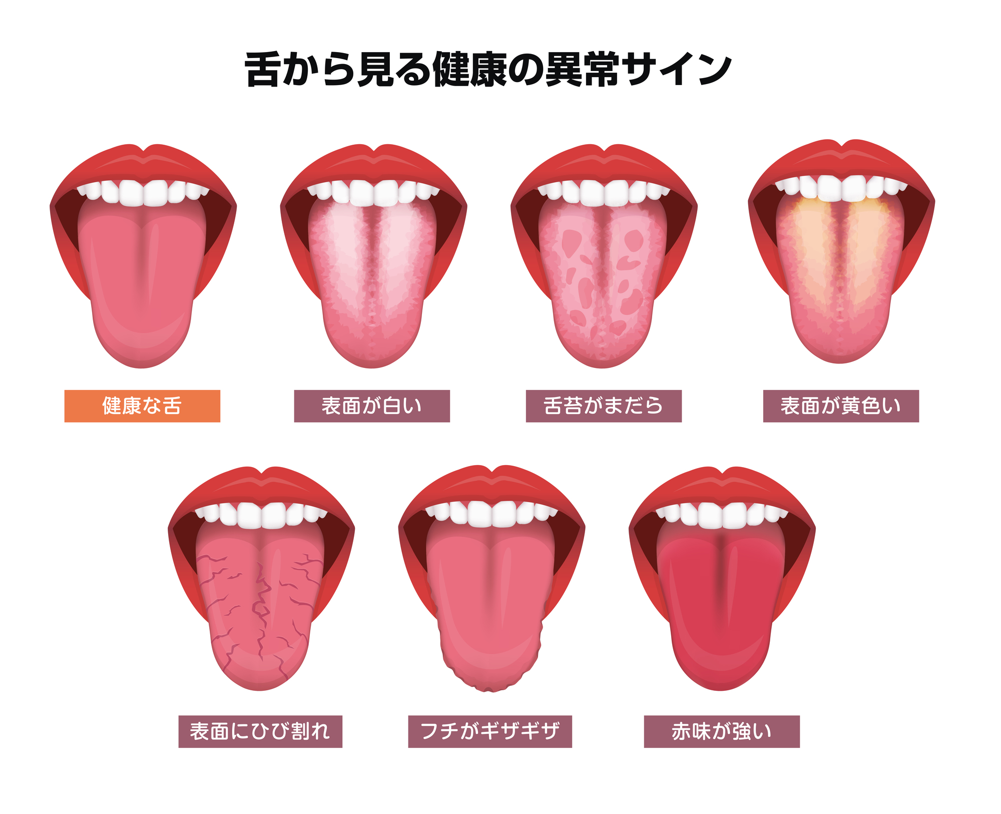 ベロが白いのは病気の予兆？放置厳禁な危険原因と最新ケアの全貌
