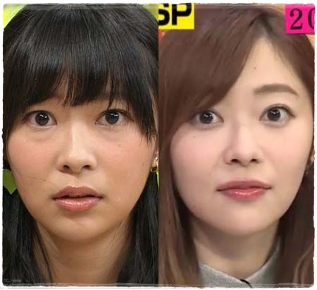 【徹底調査】 白玉 点滴 芸能人 Tiktok話題の動画 #624