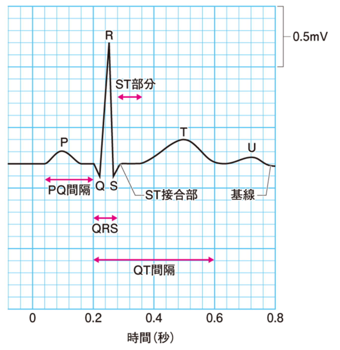 狭心症で心電図が「異常なし」の理由とは？波形変化と検査の真実