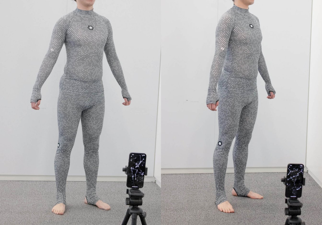 ゾゾスーツの現在は？失敗の真相と医療へ進化したZozosuit2の衝撃