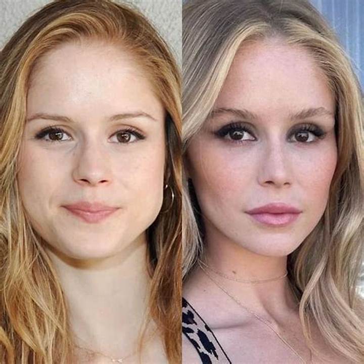 Erin Moriarty Before and After Plastic Surgery: What We Can (And Can’t) Say