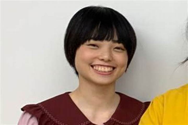 斜視を持つ芸能人女性たち——個性と魅力で輝くスターたちの素顔